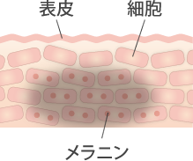 シミ・そばかすの原因